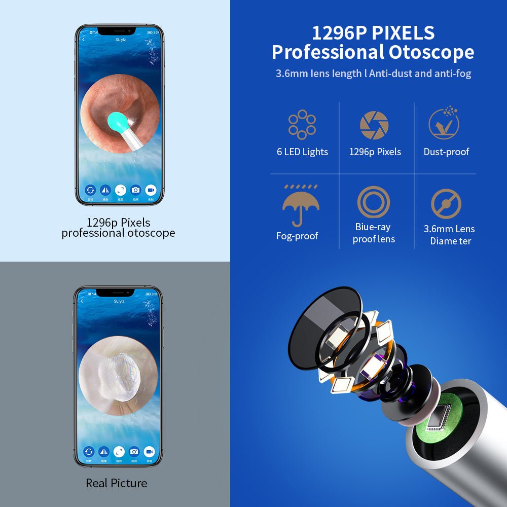 NE3 Ear Cleaner Otoscope Ear Wax Removal Tool With Camera LED Light Wireless Ear Endoscope Ear Cleaning Kit For I - phone - Expo GBlackUSB0